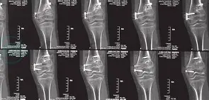 包含LPw&amp;?瘢$<婘?鋥r蜢的词条-九游娱乐APP